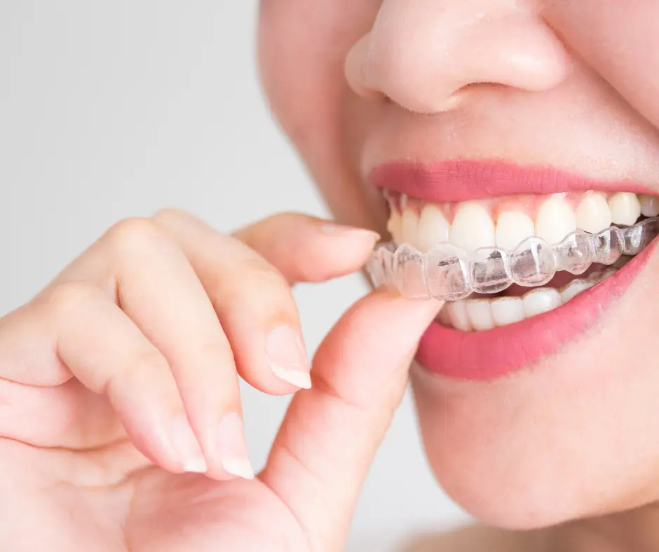 Invisalign​